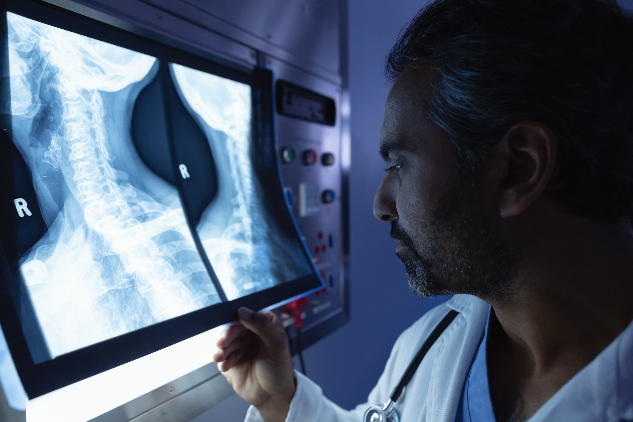 Male doctor examining x-ray on x-ray light box in operation room at hospital.